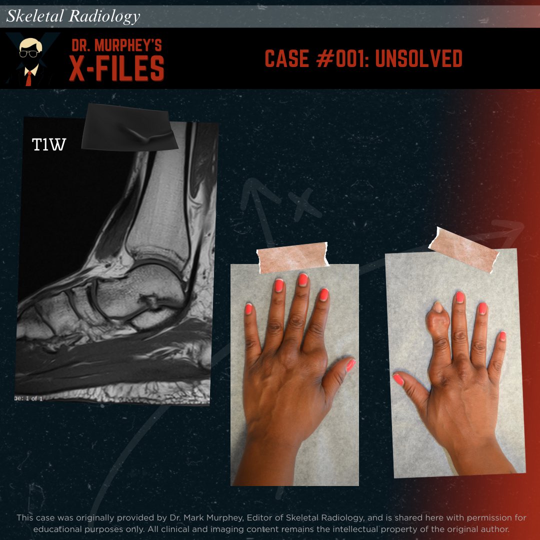 Skeletal Radiology tweet media