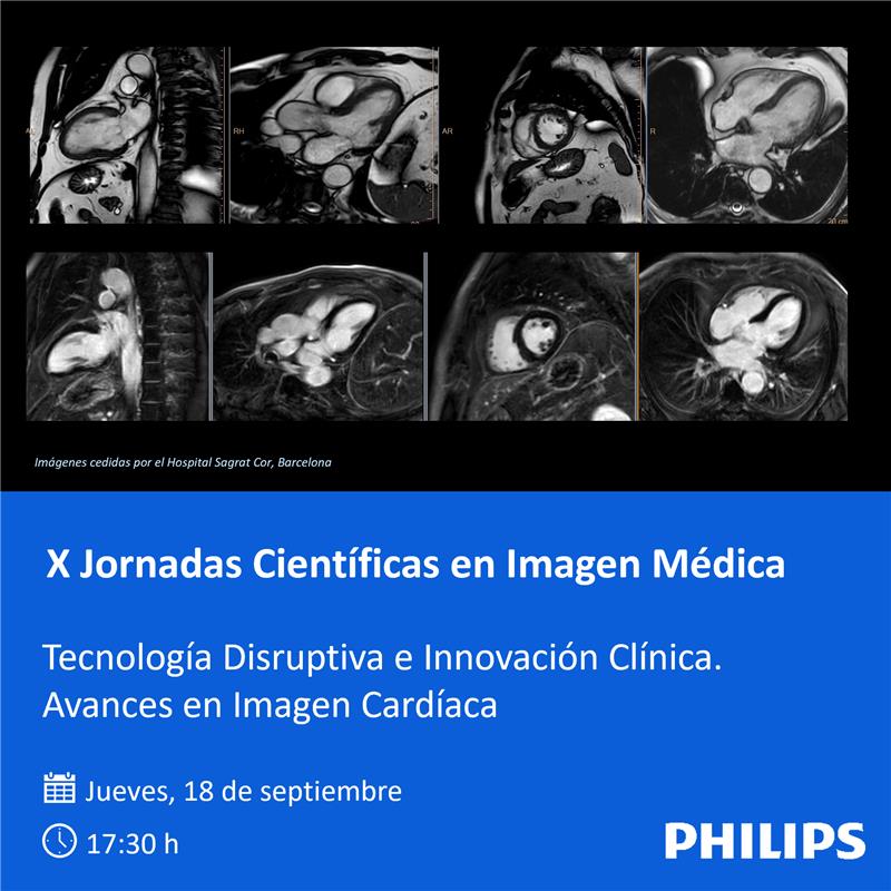 PhilipsSpain's tweet photo. Recuerde que el jueves 18 de septiembre a las 17:30, @Philips participará en las X Jornadas Científicas en Imagen Médica organizadas por la @ranm_es

Podrá asistir presencialmente en Madrid o verlo online en los canales de la RANME.

¡No se lo pierda!

#MR #Cardiología https://t.co/Uv7YNCG4zM