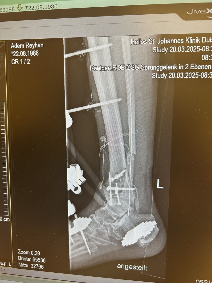 VALE (@valetersane) on Twitter photo 