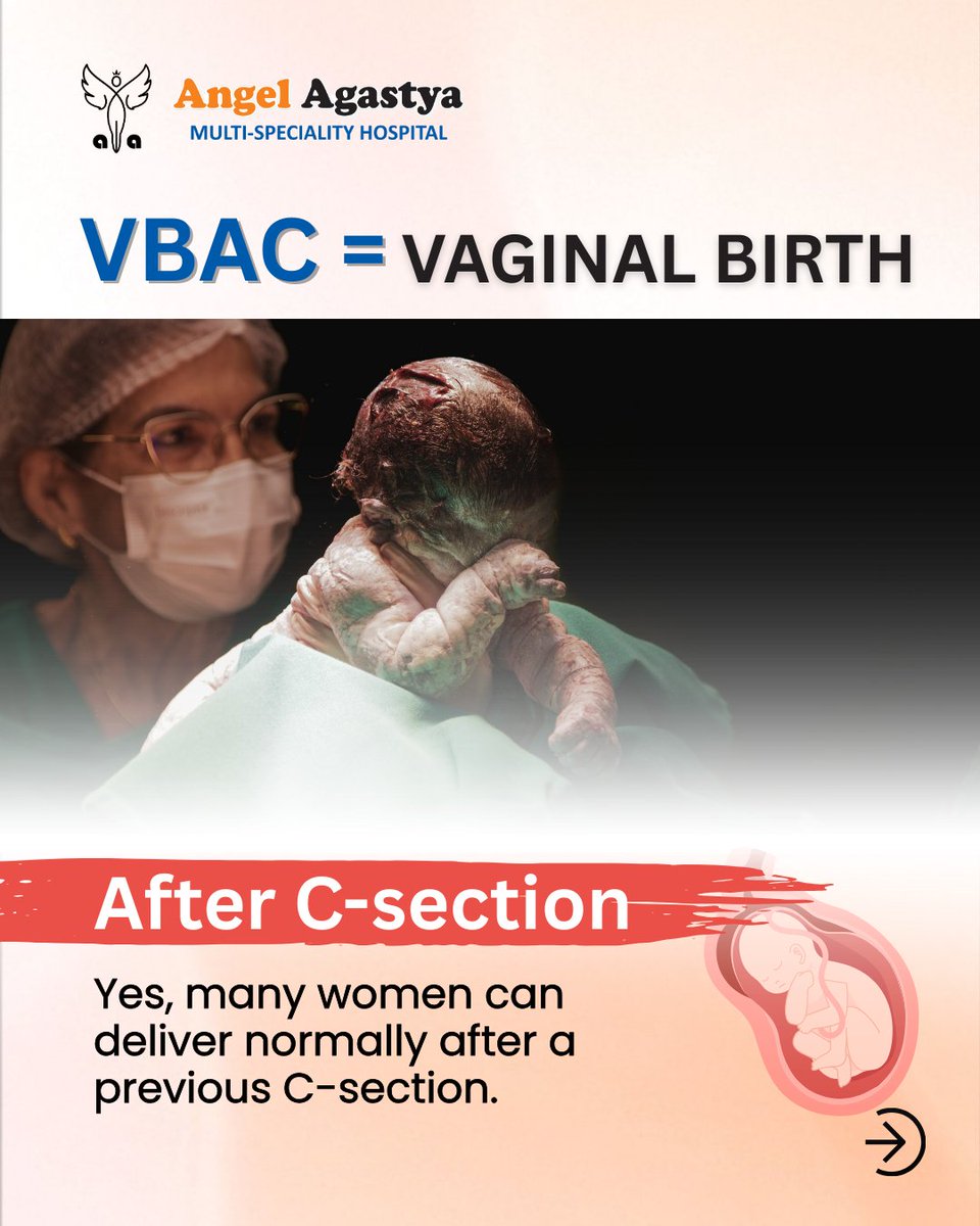 angelagastya4u's tweet image. VBAC (normal delivery after C-section) is possible in many cases. We are sharing important information so It can help clear doubts and guide many moms-to-be.
👉 Comment “VBAC” our team will guide!

#VBAC #NormalDelivery #CSectionRecovery #AngelAgastyaHospital #DrKalpanaAggarwal
