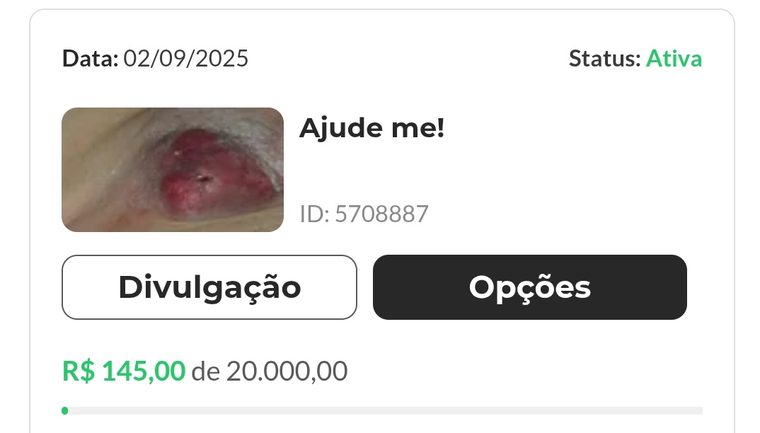 Olá, amigos!Venho aqui com o coração apertado para pedir a ajuda de vocês. Meu pai precisa passar por uma cirurgia delicada, para retirada de um tumor localizado na região da virilha. O procedimento é urgente e o valor gira em torno de R$ 20.000,00.

vakinha.com.br/vaquinha/ajude…