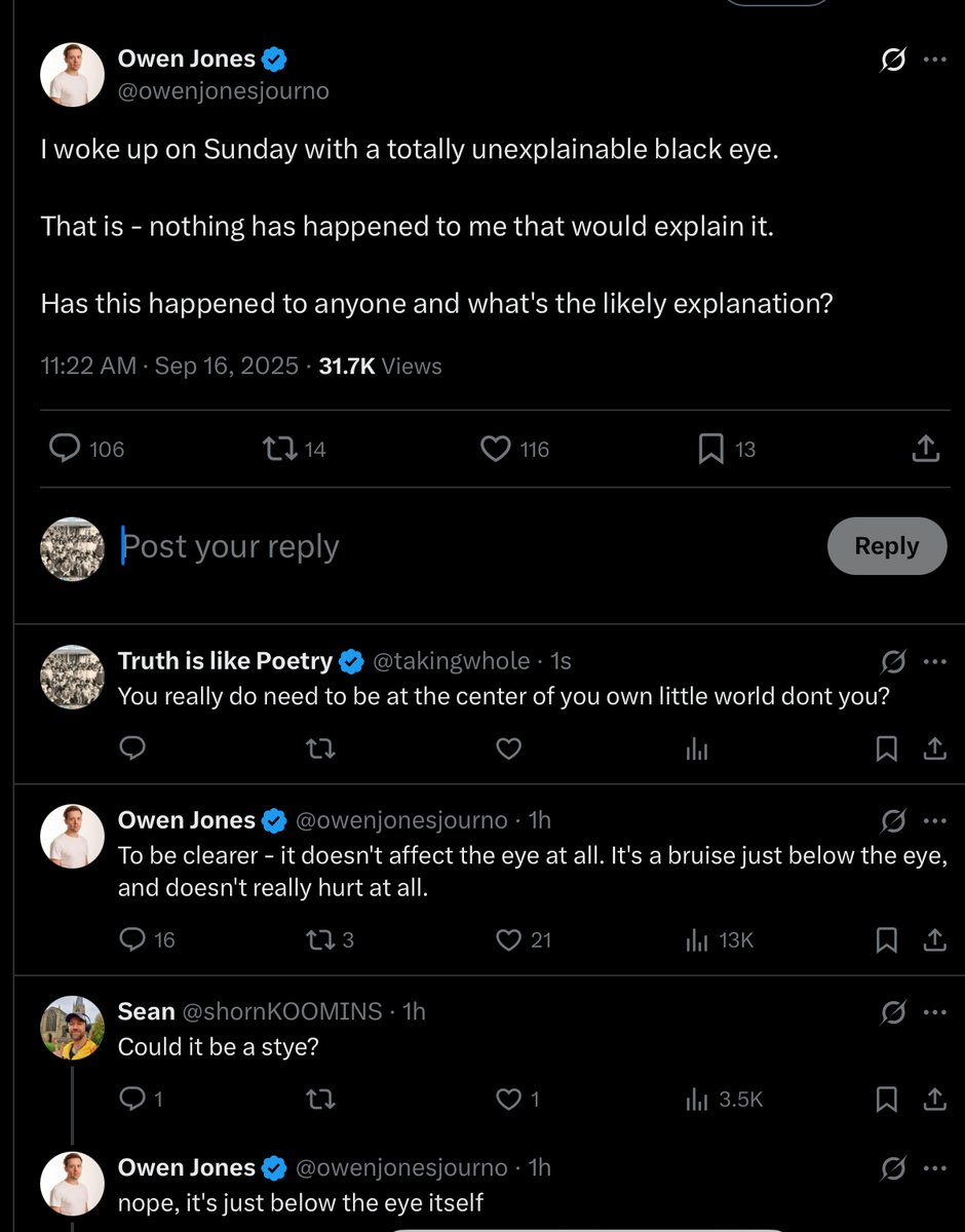 With all the things going on in the world, Owen Jones is stressing about a hurty eye.  

He really is desperate for attention….