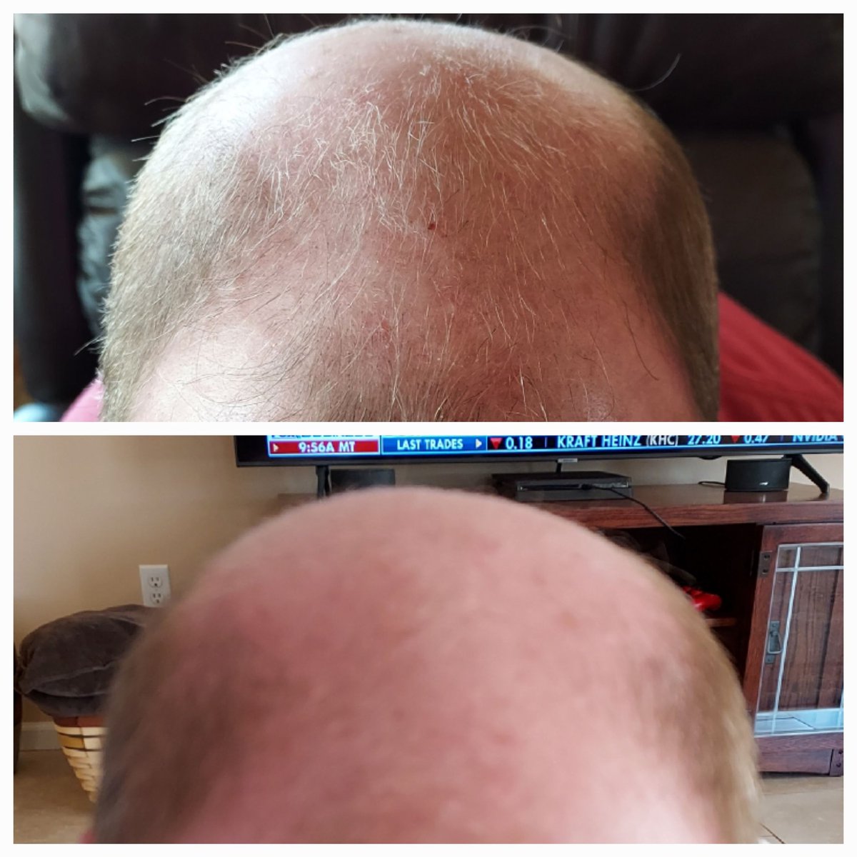 TimC42163675's tweet photo. 2 weeks before and after https://t.co/oy2wNqI88g