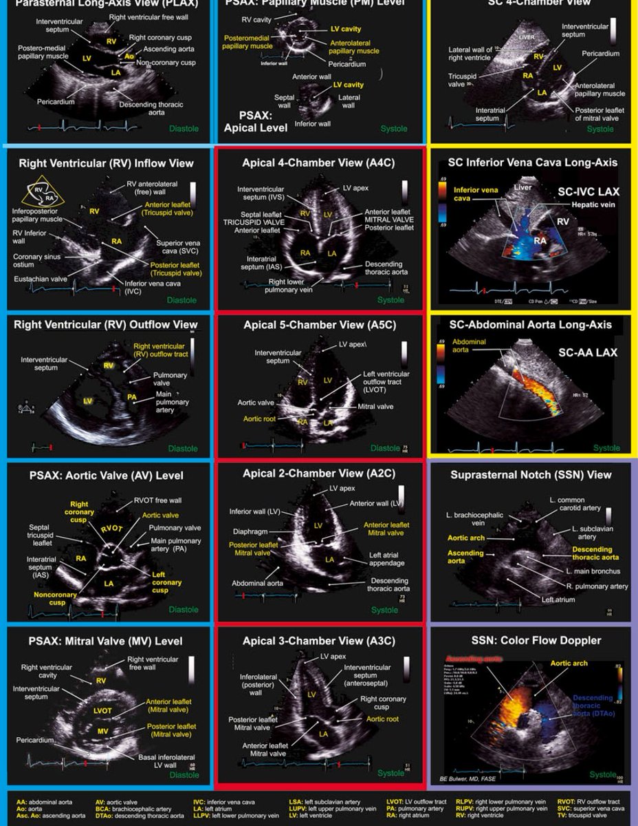 Transthoracic Echocardiographic (TTE) Views: A Complete Guide

Understanding TTE views is essential for accurate cardiac imaging. Let’s break down the 5 core views:
1️⃣ Parasternal Long Axis
2️⃣ Parasternal Short Axis
3️⃣ Apical
4️⃣ Subxiphoid
5️⃣ Suprasternal

A thread 🧵