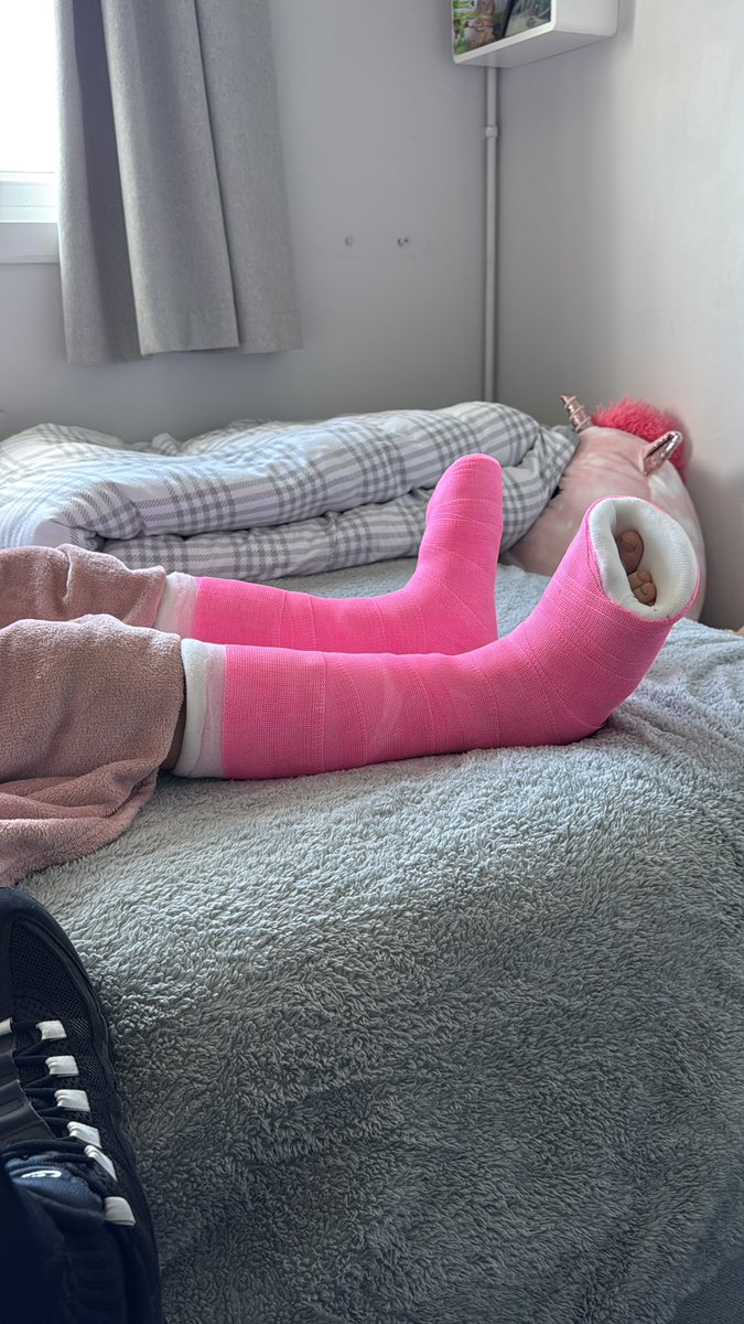 Day 2 of recovery. Managed to stand earlier today. But it was tough. But I will keep trying. 

Do you like my casts? 

Thank you for all your kind words of support 💙❤️