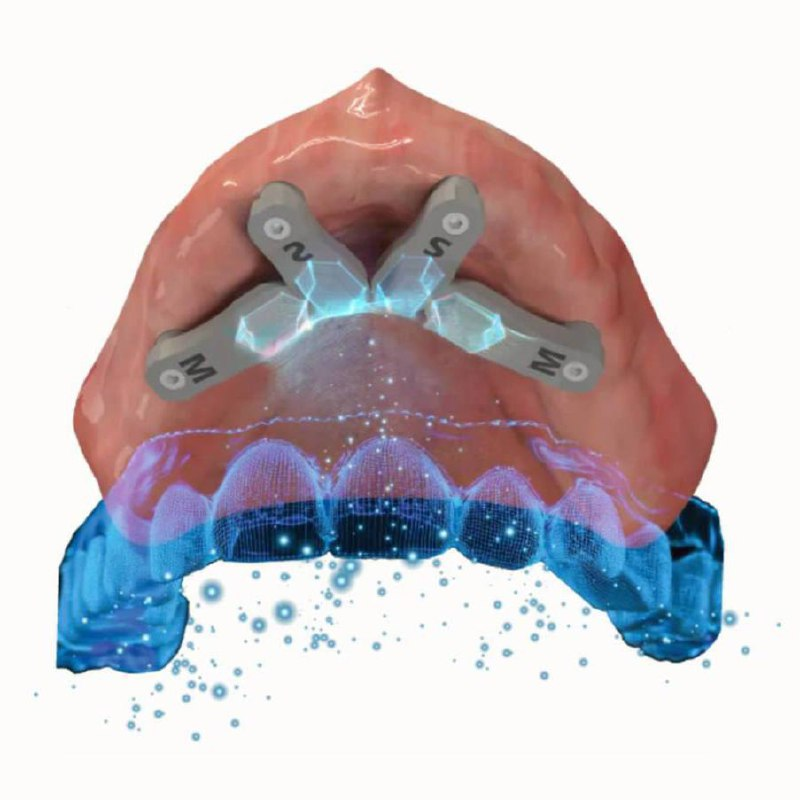 otexeworld's tweet photo. 🇺🇸 The largest dental conference in the USA showcased the Triabatment system — a breakthrough in 3D implant positioning via intraoral scanning. Its key advantage: high accuracy along the arch, crucial for full-mouth rehab and complex cases. https://t.co/0UMxff8l4x