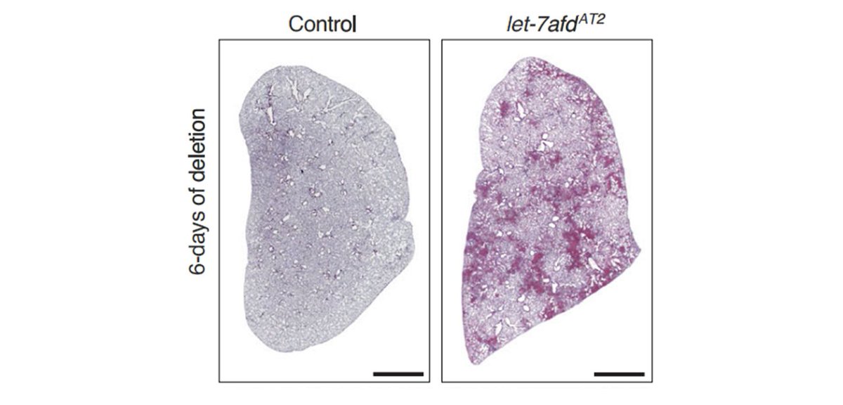 September is #PulmonaryFibrosisAwarenessMonth. Learn about #Let7, a gene that is key to keep pulmonary fibrosis in check. <a href="/ARodCastro/">AntonyRod. (microRNA Lab)</a> <a href="/MJSeasock/">Matthew Seasock, PhD</a> <a href="/CCoarfa/">Cristian Coarfa</a> et al <a href="/bcmhouston/">BCMHouston</a> <a href="/BCMDeptMedicine/">BCM Department of Medicine</a> <a href="/NatureComms/">Nature Communications</a> blogs.bcm.edu/2025/05/20/fro…