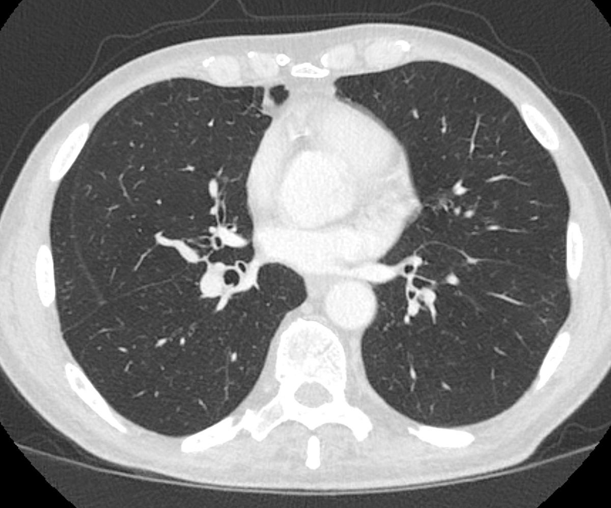 Bruno Hochhegger tweet media