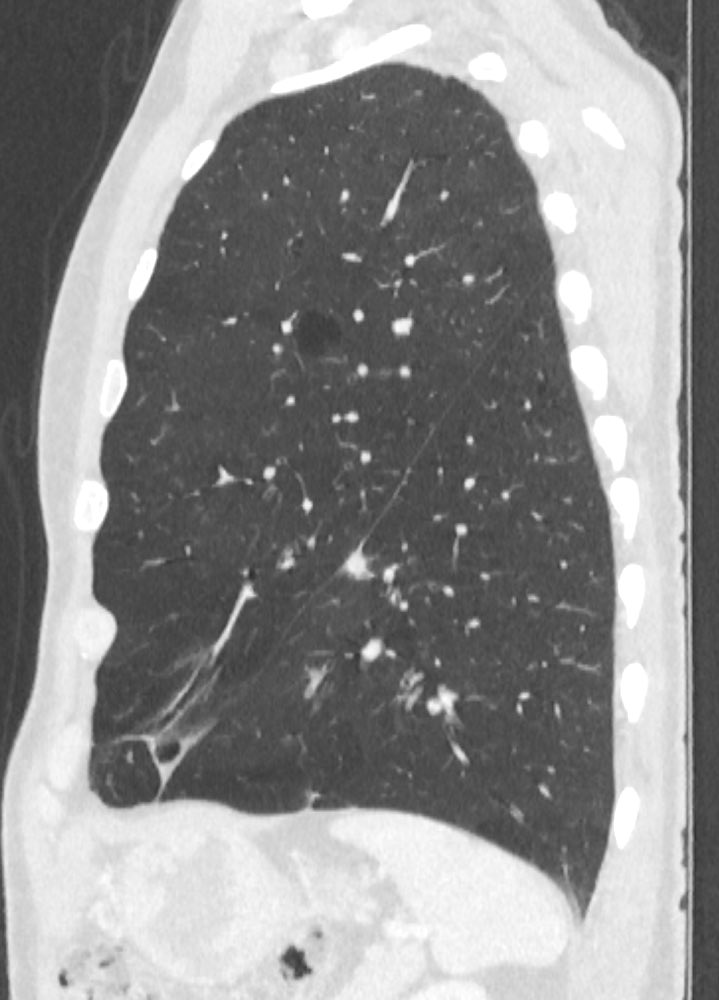 Bruno Hochhegger tweet media