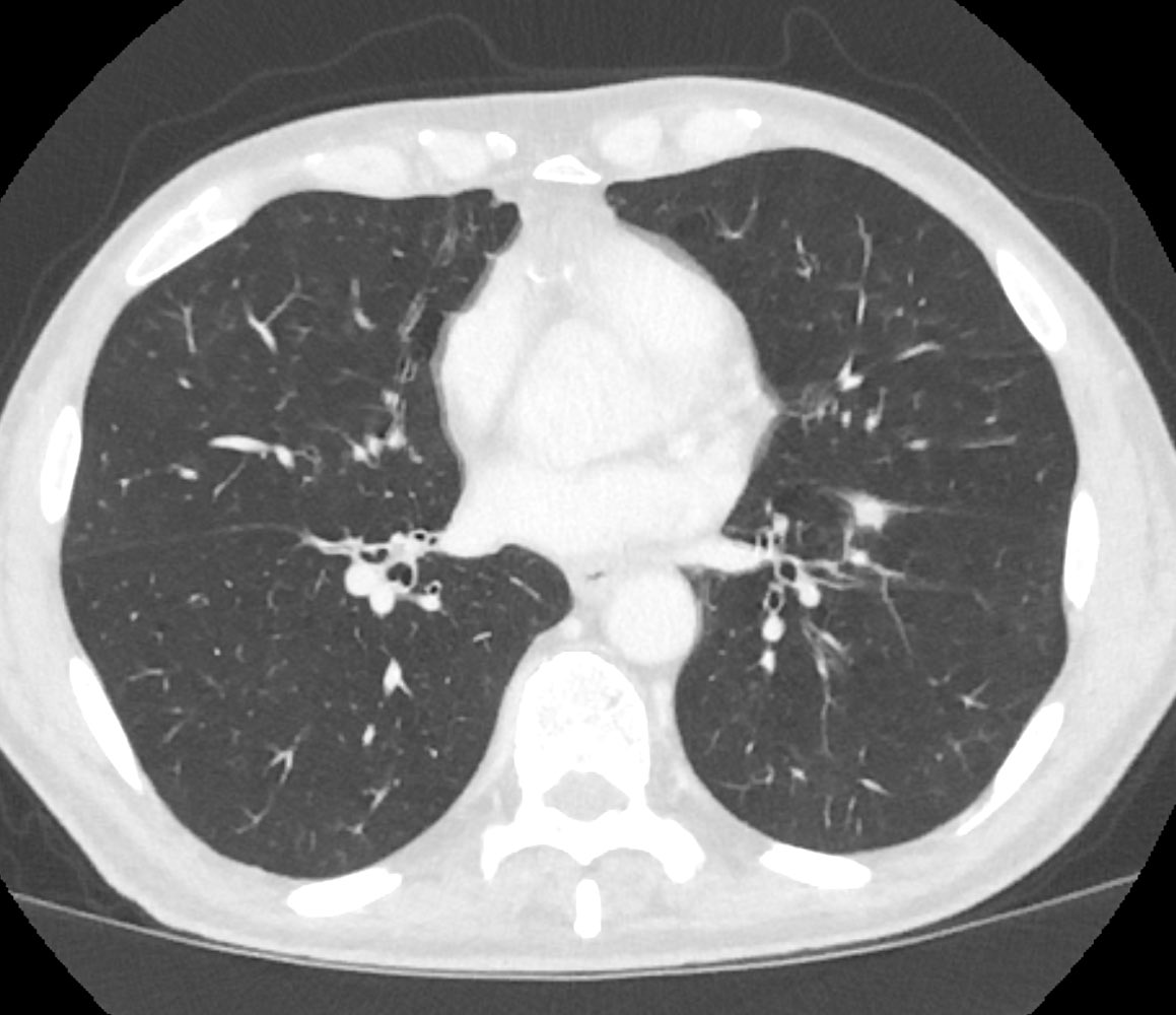 Bruno Hochhegger tweet media