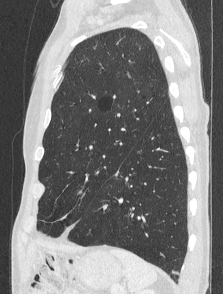 Bruno Hochhegger tweet media