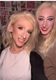 IntenseDB tweet media