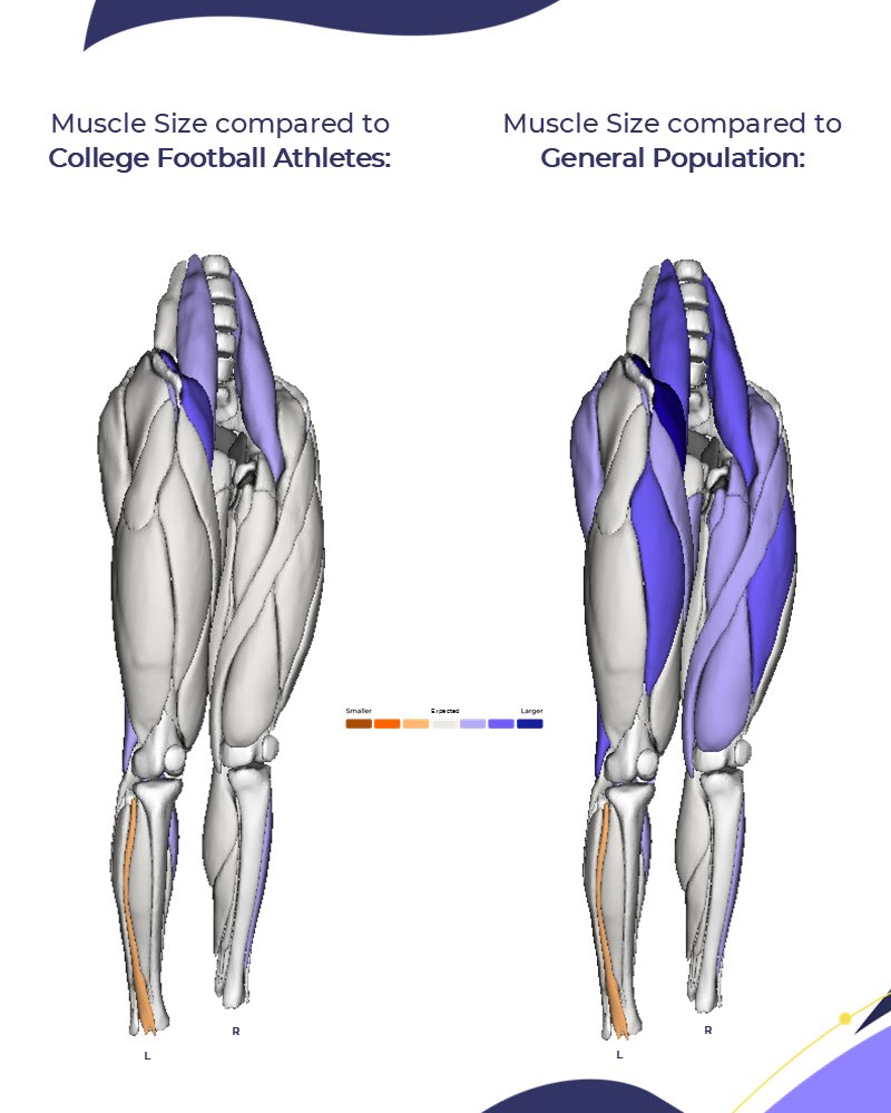 SpringbokTech's tweet image. Introducing our largest sport-specific database yet: 𝗧𝗵𝗲 𝗖𝗼𝗹𝗹𝗲𝗴𝗶𝗮𝘁𝗲 𝗔𝗺𝗲𝗿𝗶𝗰𝗮𝗻 𝗙𝗼𝗼𝘁𝗯𝗮𝗹𝗹 𝗗𝗮𝘁𝗮𝗯𝗮𝘀𝗲.
Subjective impressions can only go so far. True performance health comes from objective, measurable data that shows where an athlete is today, and…