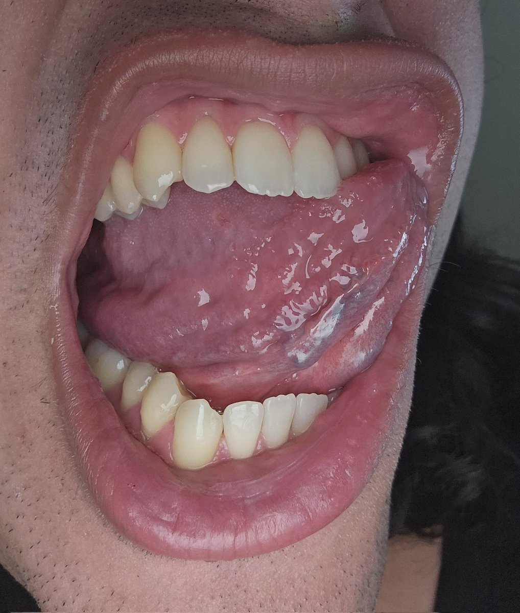 Haven't got much to offer in the way of captions for these – just hungry and wanted to show off a few days back! Still mostly inactive here, but open through other avenues.

#oralvore #mouthplay
