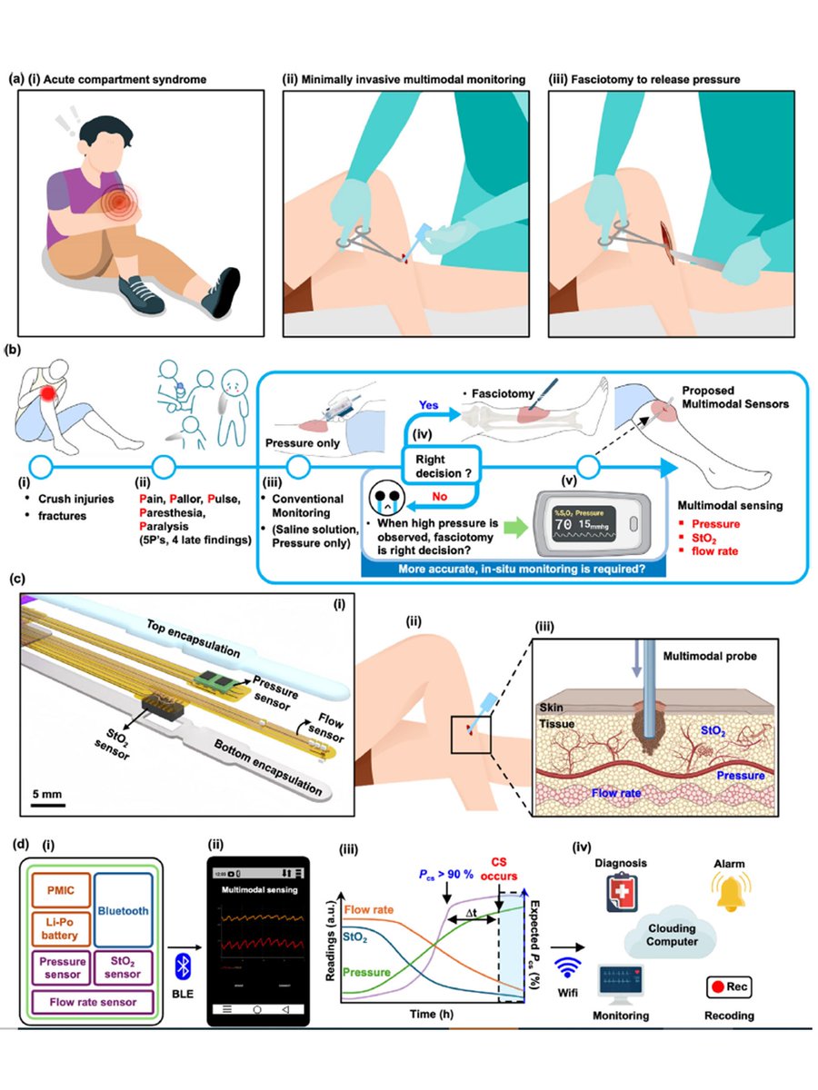 ProfJohnARogers's tweet image. For our latest work on thin, flexible probes for patient monitoring, take a look at the paper published today in Advanced Science, titled “Minimally Invasive, Bioadaptive Multimodal Sensor Probe with Safe Deployment for Real‐Time Acute Compartment Syndrome Diagnosis.”…