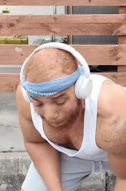 Guys his hair follicles are fighting for their LIFE and he had the audacity to ask that lady where her hair is. Big man where is your own????