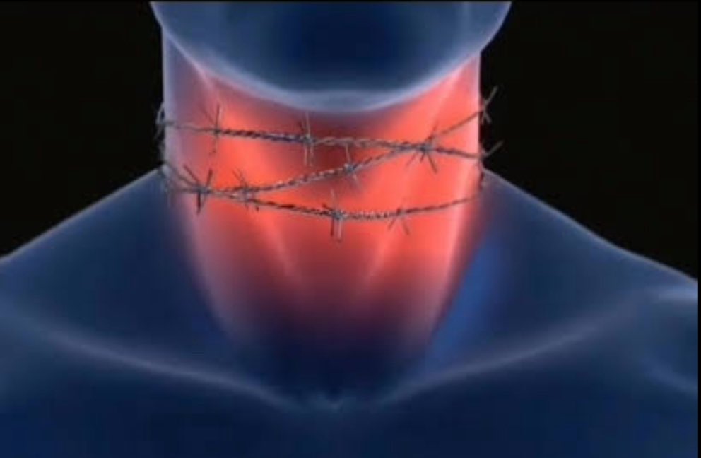 luisauseche's tweet image. El nudo en la garganta duele como una amigdalitis 🥴