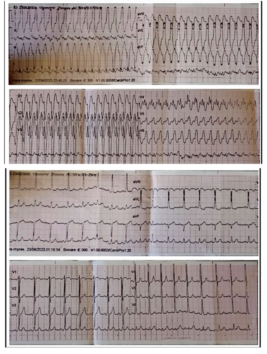 ALBERTO ALFIE tweet media