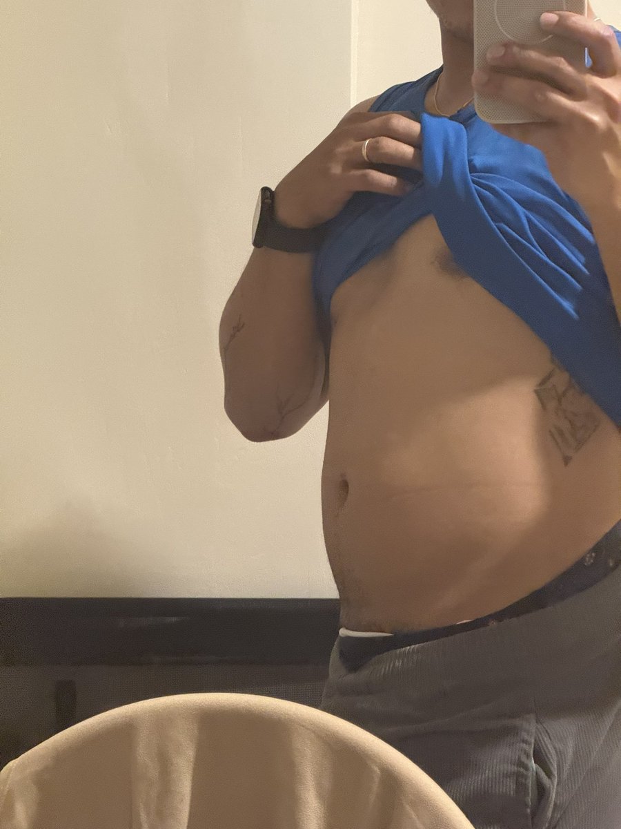 bumbleboi12's tweet photo. Before Vacation vs. 4weeks in the Philippines https://t.co/C8Msmy3KC6