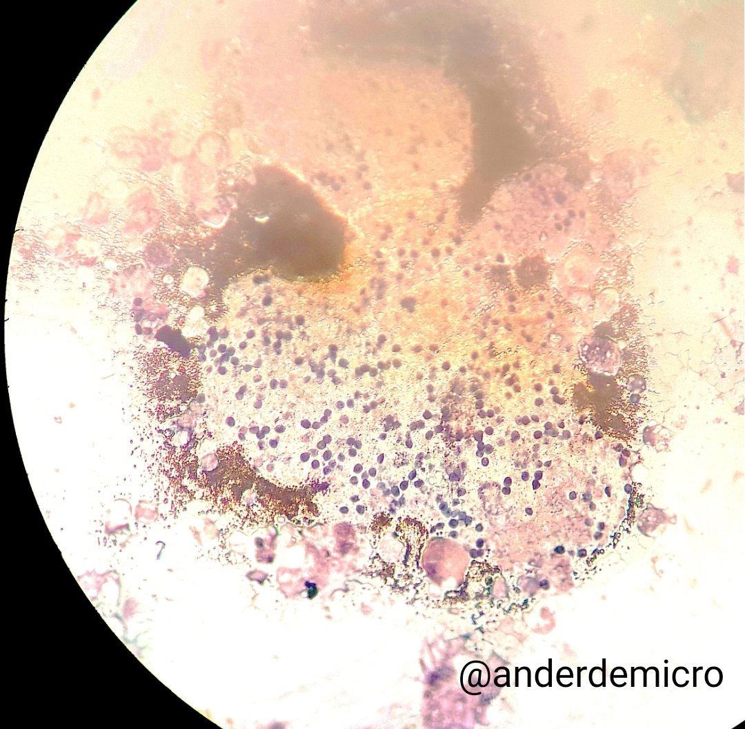 Ander González-Sarría tweet media