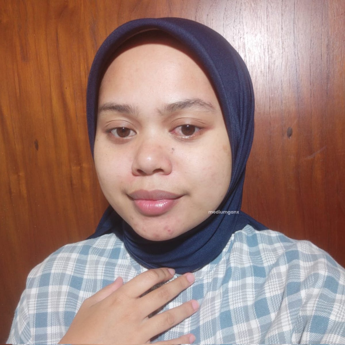 Nyari facial wash yang gentle tapi tetep deep cleansing?

Cobain Clinelle Deep Cleansing Gel deh, kulit sensitif pun aman gak bikin kering, gak bikin perih, tapi tetep bersih maksimal ✨