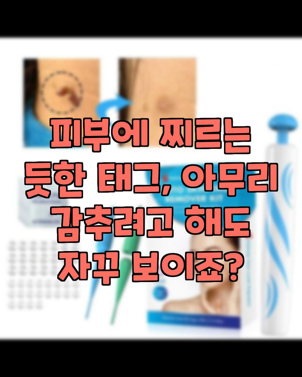 zooeun925's tweet photo. 🩵생활 쿠팡 추천템 소개🩵
영상속 제품이 궁금하다면?

👇
https://t.co/5Iqhvzag1u

✨️이 포스팅은 쿠팡 파트너스 활동의 일환으로, 이에 따른 일정액의 수수료를 제공받습니다✨️

 #광고 #피부케어 #피부태그제거 #간편제거 #정품제거도구 #피부관리 #톡탁 #toktak #자신감회복 https://t.co/dtaLLaJMd8