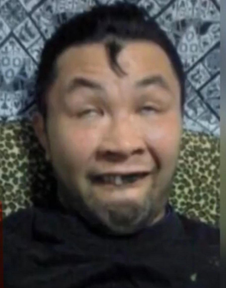 ハゲたくないけどハゲてきてるかな…？