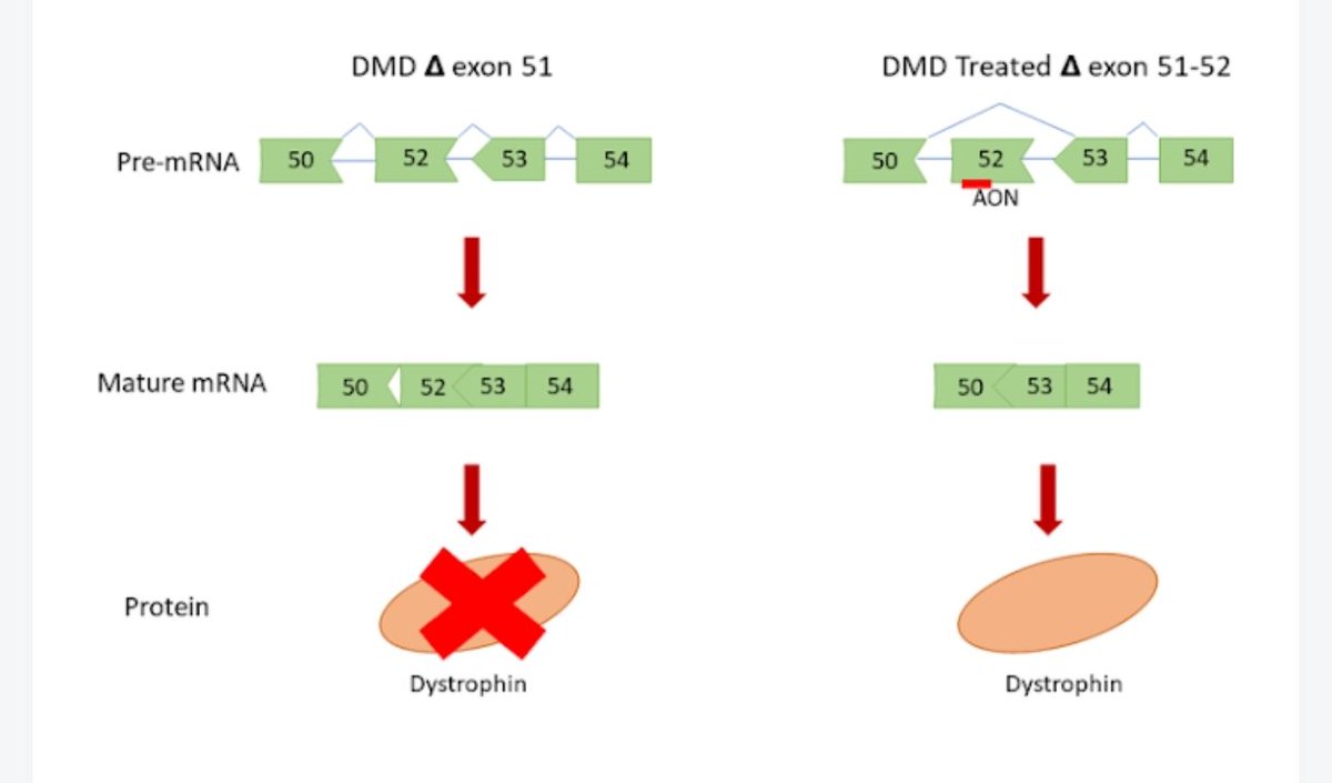 Duchenne Kas Hastalığı, sadece bir bireyi değil, tüm aileyi etkileyen bir mücadeledir. Bu mücadelede en büyük güç, sevgiyle saran ailelerin kalbidir.

Ancak sevgi tek başına yetmez. Bilim ilerliyor, umut büyüyor. Özellikle ekzon atlama tedavileri, DMD’li çocuklarımız için kalıcı