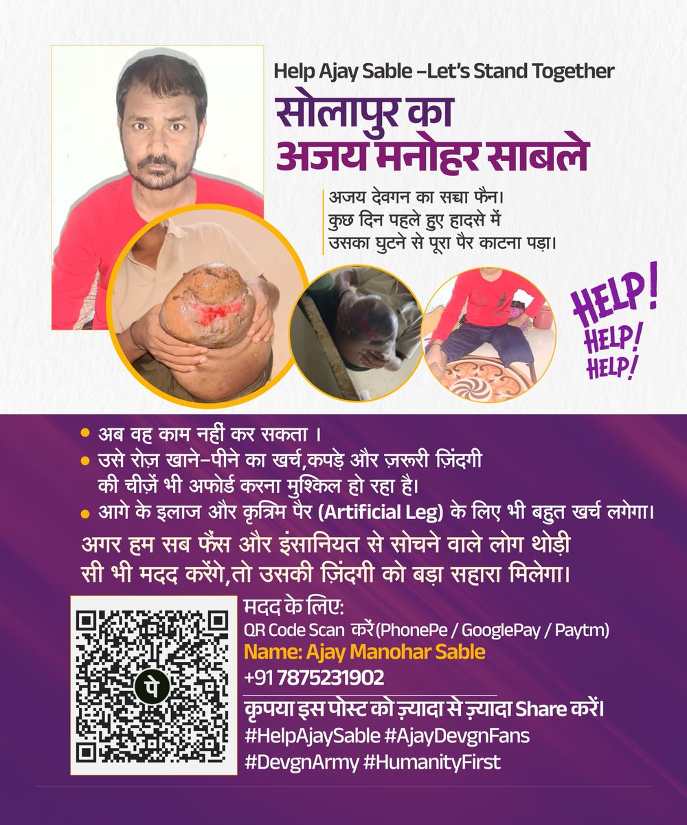 ASuyog79's tweet photo. ЁЯЩП Help Ajay Sable тАУ LetтАЩs Stand Together ЁЯЩП
#AjayDevgn Fan
рдЕрдкрдШрд╛рддрд╛рдд рддреНрдпрд╛рдЪрд╛ рдЧреБрдбрдШреНрдпрд╛рдкрд╛рд╕реВрди рдкреВрд░реНрдг рдкрд╛рдп рдХрд╛рдврд╛рд╡рд╛ рд▓рд╛рдЧрд▓рд╛.
рд╕рд░реНрд╡ рдлреЕрдиреНрд╕ рд╡ рдорд╛рдгреБрд╕рдХреАрдиреЗ рд╡рд┐рдЪрд╛рд░ рдХрд░рдгрд╛рд░реЗ рд▓реЛрдХ рдЬрд░ рдереЛрдбреАрд╢реА рдорджрдд рдХреЗрд▓реА, рддрд░ рддреНрдпрд╛рдЪреНрдпрд╛ рдЬрдЧрдгреНрдпрд╛рд▓рд╛ рдореЛрдард╛ рдЖрдзрд╛рд░ рдорд┐рд│реЗрд▓
#HelpAjaySable #AjayDevgnFans #DevgnArmy #Humanityfirst https://t.co/LHUBVeu7bb