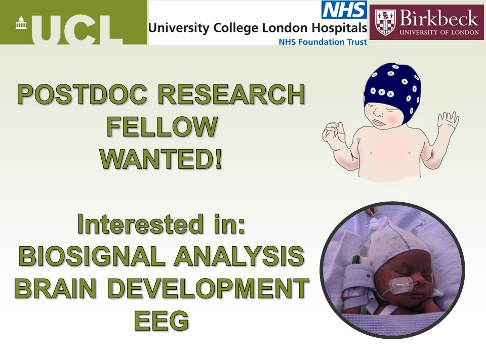 🔬🧠👶 We're hiring!
Join a new research project at #UCL, #UCLH and #Birkbeck with <a href="/LFabriziUCL/">Lorenzo Fabrizi</a> and <a href="/EmilyDevNeuro/">Emily Jones</a>.
📍 Neonatal Brain Imaging
🧪 EEG + sensory testing
🎓 Medical Physics, Bioengineering, Comp Neuro
📅 Deadline: 25 Sept 2025
📋 Apply: tinyurl.com/yc8r66b4