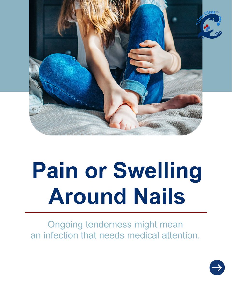 TripleClearHF's tweet image. Your nails tell a story—don’t ignore it.

Discoloration, brittleness, or ridges can signal deeper issues.

Fix the cause naturally with Triple Clear HF.

Start now.

#NailHealth #TripleClearHF #NaturalHealing #HealthyNails #FungalTreatment