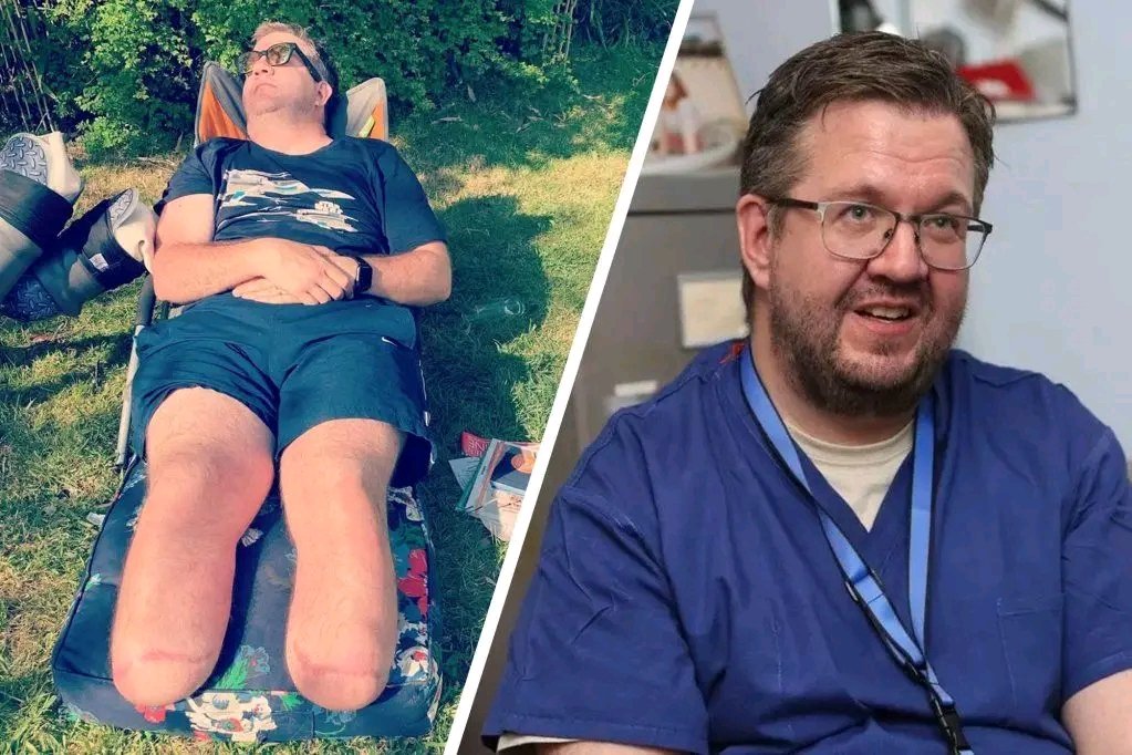 MDNnewss's tweet photo. Former NHS surgeon jailed for £466,000 insurance fraud after self-amputations

A former NHS vascular surgeon has been sentenced to 32 months in prison for a shocking insurance fraud scheme involving the deliberate amputation of his own legs.

Neil Hopper, 49, from Cornwall in England, UK froze his legs with dry ice in 2019, causing surgical removal, and falsely claimed the amputations were due to sepsis. 

He received £466,653.81 in payouts from insurers Aviva and Old Mutual Health, which he spent on luxury items including a £22,000 campervan, a £15,000 hot tub, and home renovations.

Hopper, who performed hundreds of amputations during his career, admitted that his actions were motivated by both greed and a long-standing sexual interest in amputation. 

In addition to two counts of fraud by false representation, he pleaded guilty to three charges of possessing extreme pornographic material connected to the “Eunuch Maker” website. 

He was handed a 10-year Sexual Harm Prevention Order alongside his prison sentence.

Judge James Adkin described the case as “exceptionally high” in harm, noting Hopper misled medical professionals by claiming his injuries were illness-related. 

Despite returning to work at Royal Cornwall Hospital on prosthetic legs and even winning the 2020 “Against All Odds” Amplifon Award, Hopper has been suspended from the medical register since December 2023.

The Royal Cornwall Hospitals NHS Trust confirmed the offences were unrelated to his professional conduct, and no patients were at risk.
