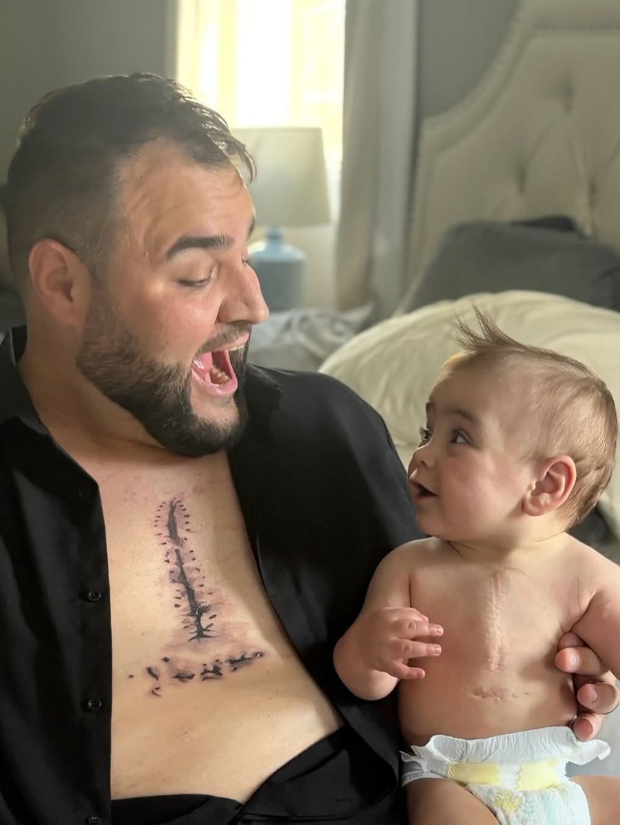 Un padre decidió rendir homenaje a la valentía de su hijo tatuándose la cicatriz que marcó su pequeño pecho. Benny, el niño, logró sobrevivir a una cirugía que le salvó la vida de una enfermedad cardíaca congénita, y esa huella se convirtió en el relato visible de supervivencia.