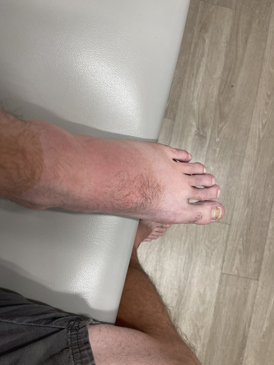 The_Cat_Poo's tweet photo. @IndicaFlowerxxx Ice bath was the only thing that helped when my ankle got stung https://t.co/UPT1RPVund