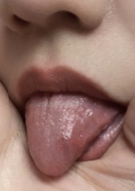 밥먹다 혀깨물었어. 아파 죽겠네🥲