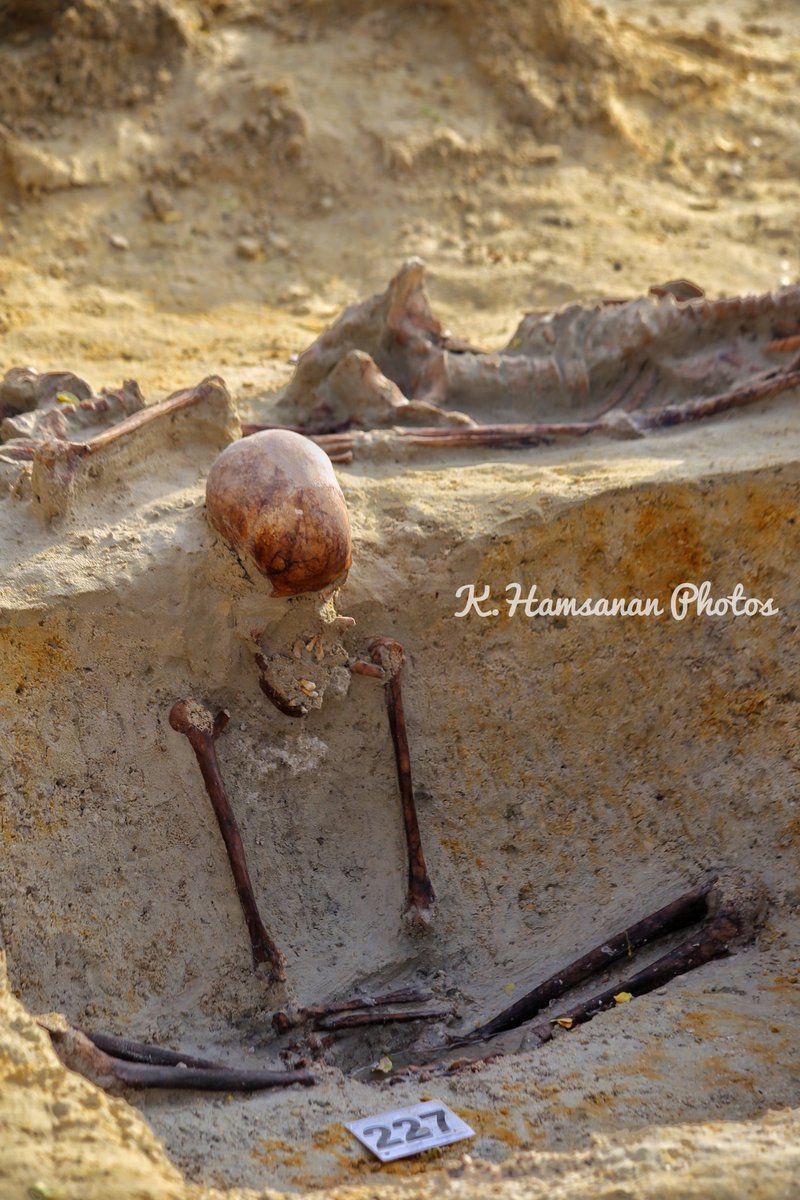 கைகள் கட்டியபடி, கால்கள் மடித்து அமர்ந்திருந்திருக்கும் எலும்புக்கூடு செம்மணி புதைகுழியில் அடையாளப்படுத்தப்பட்டுள்ளது.
அதன் தலை வலது பக்கமாக சாய்ந்து கீழே பார்த்தவாறு காணப்படுகின்றது. மண்டையோட்டின் இடது பக்கம் உடைந்த நிலையிலும், தடை சிதைந்தும் உள்ளது.
#செம்மணிபுதைகுழி #Chemmani