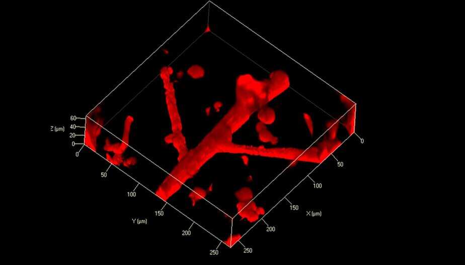 3dheals's tweet image. “Standardization is key.” 📏 BIO INX is pushing #3Dbioprinting beyond academia by making high-performance, reproducible #bioinks with partners like Rousselot—bringing consistency to biofabrication.
👉 3dheals.com/interview-with…

#TranslationalMedicine #BiotechInnovation.