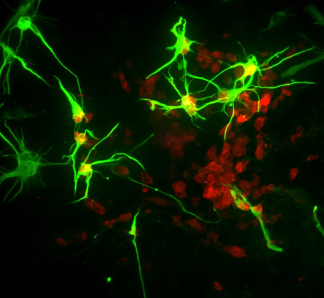Image of cultured human astrocytes from <a href="/MandiLicht/">Mandi Lichtenstein</a>. GFAP in green and pSTAT3 in green. These cells were treated with pro-inflammatory molecules (IL-1b and TNFa). This is the first experiment in the lab with these cells :)

#FluorescenceFriday #AstrocyteLover