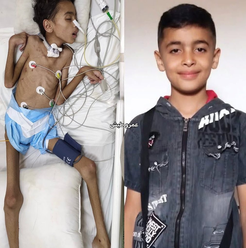 Before &amp; After 🇵🇸💔