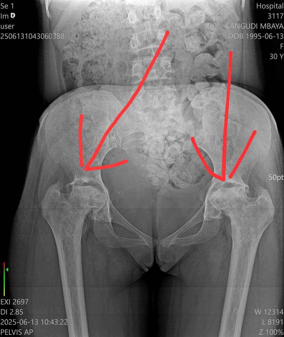 🔴 APPEL À L’AIDE POUR ALLEGRA  

Notre sœur Allegra est gravement malade et a besoin d’une évacuation urgente vers la France pour des soins médicaux spécialisés.  

Sa famille, malheureusement en difficulté financière, ne peut réunir seule les 23.000 dollars nécessaires à son