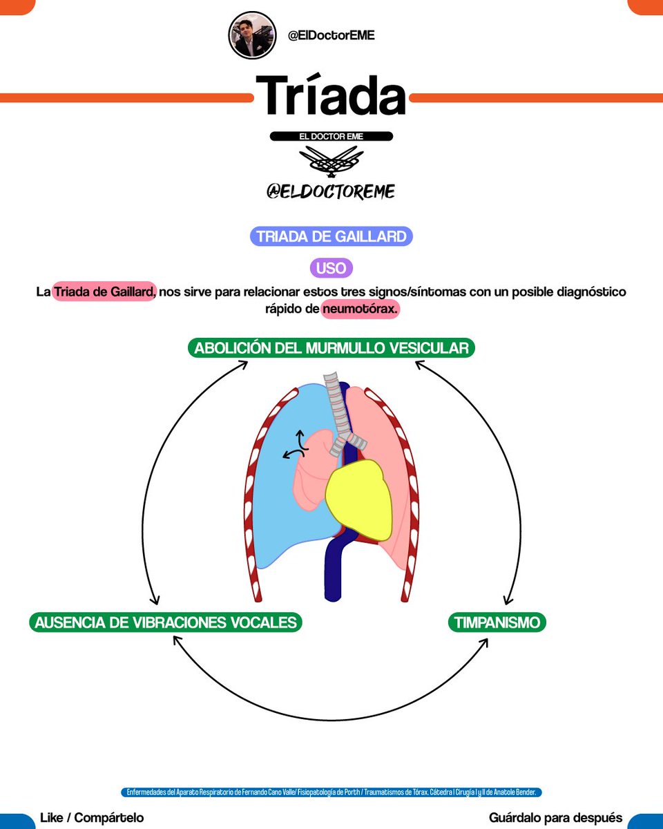 🤓GUÍA RÁPIDA: NEUMOTÓRAX🤓
📌Hilo con📌

•Neumotórax a tensión
•Neumotórax abierto
•Triada de Gaillard

Encuentra más información en instagram.com/eldoctoreme

#ENARM #MIR #USMLE #ENARM2025