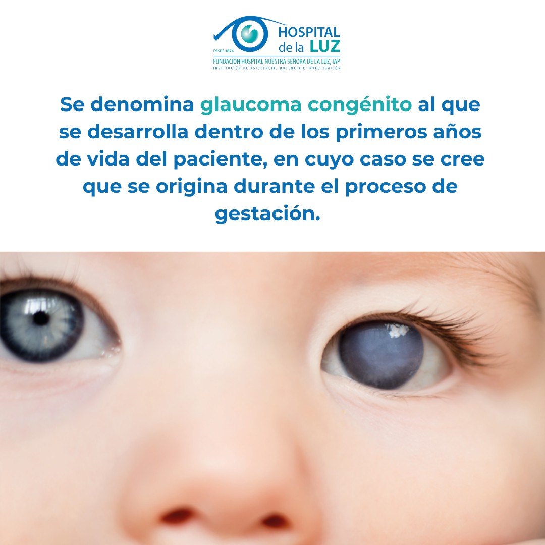 Se denomina glaucoma congénito al que se desarrolla dentro del primero año de vida del paciente, en cuyo caso se cree que se origina durante el proceso de gestación. Es el tipo menos común de glaucoma.