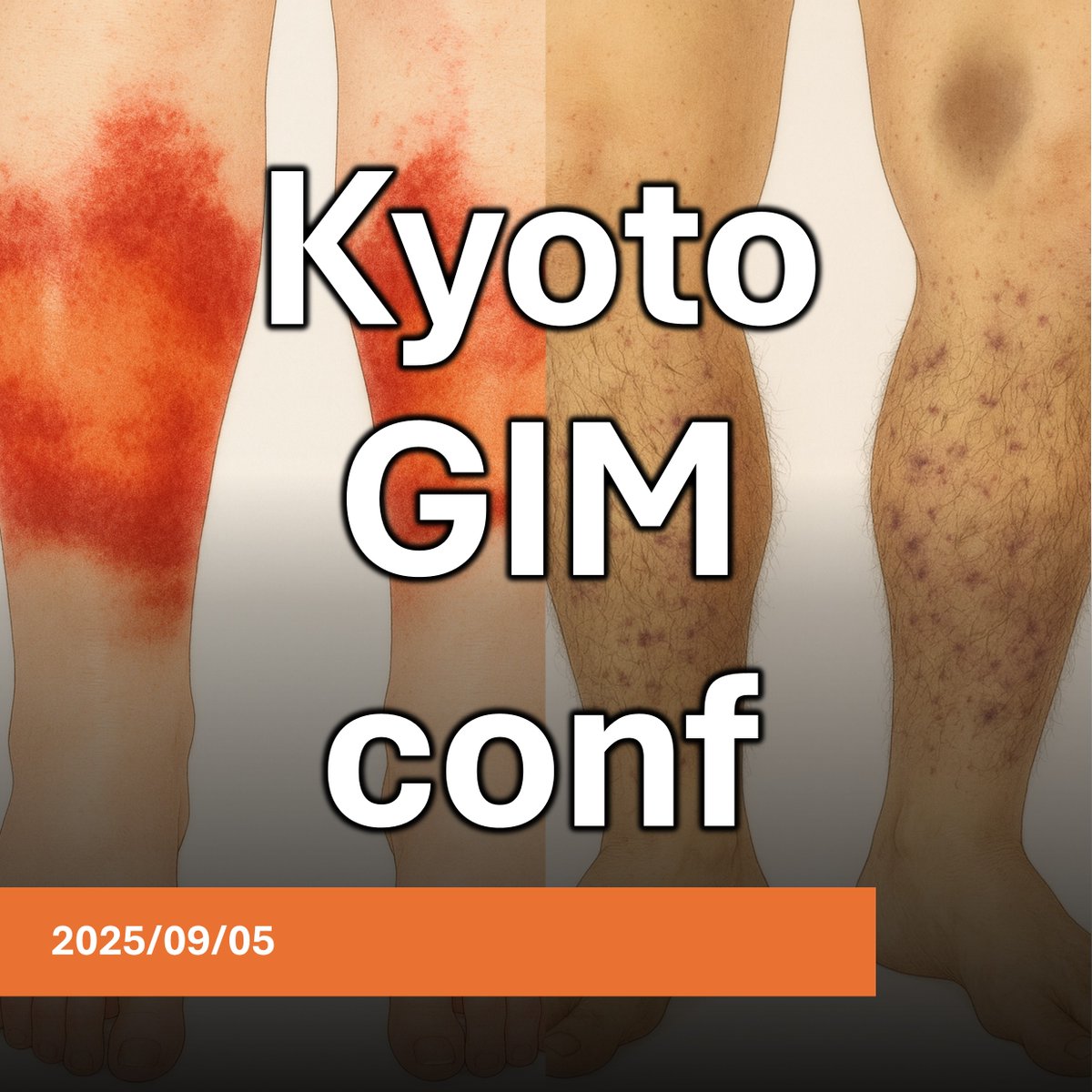 zCPAeok4TYzfLDA's tweet image. 真夏に長距離歩いて、パスタソースもかけずにパスタを食べ続けたら・・・
rakuwa.or.jp/maruta/med/gim…
#京都GIM #医学 #症例 #勉強会 #丸太町病院