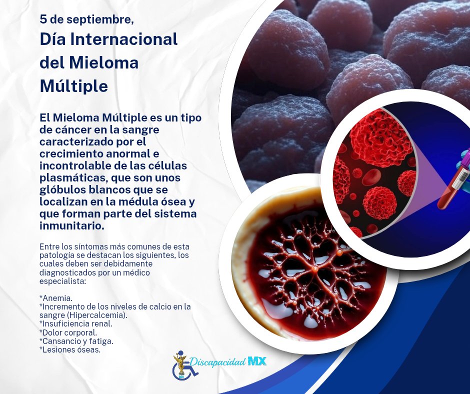 El Mieloma Múltiple es un tipo de cáncer en la sangre caracterizado por el crecimiento anormal e incontrolable de las células plasmáticas, que son unos glóbulos blancos que se localizan en la médula ósea y que forman parte del sistema inmunitario.

#DiscapacidadMx #efemeridesv