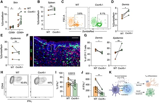 Waggoner Lab (@labwaggoner) on Twitter photo CXCR6 promotes dermal CD8+ T cell survival and transition to long-term tissue residence <a href="/J_Immunol/">The Journal of Immunology</a> <a href="/theLundLab/">Amanda Lund Lab</a> <a href="/TaylorAHeim/">Taylor Heim</a> <a href="/nyugrossman/">NYU Grossman School of Medicine</a> 🇺🇸
academic.oup.com/jimmunol/advan… CXCR6 promotes dermal CD8+ T cell survival and transition to long-term tissue residence <a href="/J_Immunol/">The Journal of Immunology</a> <a href="/theLundLab/">Amanda Lund Lab</a> <a href="/TaylorAHeim/">Taylor Heim</a> <a href="/nyugrossman/">NYU Grossman School of Medicine</a> 🇺🇸
academic.oup.com/jimmunol/advan…