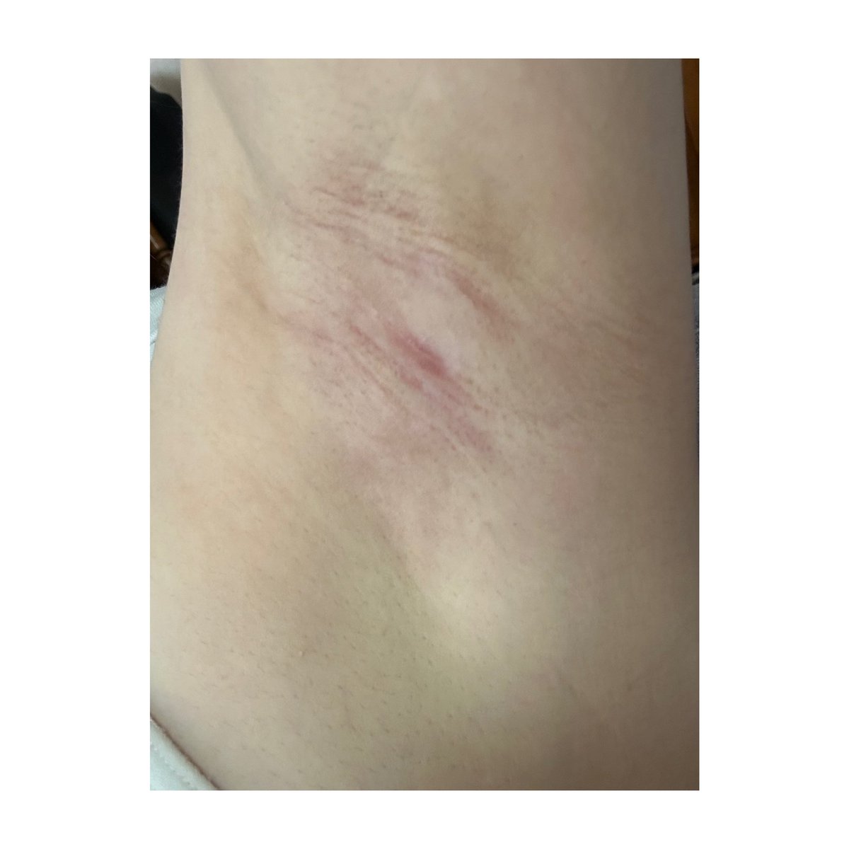 普通のOL(剪除法レポ) tweet media