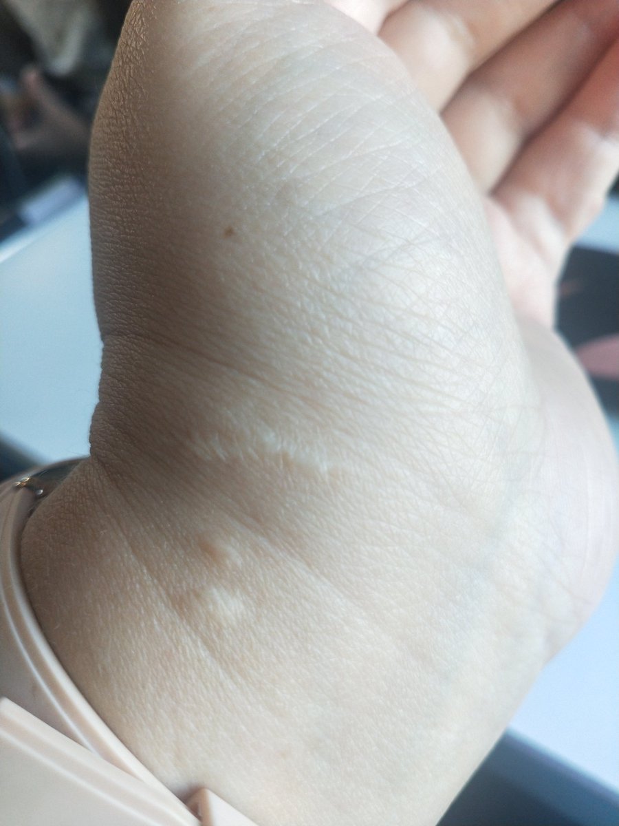 Все таки решилась сделать тату на место шрама от укуса собаки) вот теперь думаю какой рисунок сделать чтобы не большой был красивый и закрыть шрам)) посоветуйте пожалуйста какие-нибудь рисунки) можно и бтс тоже😁