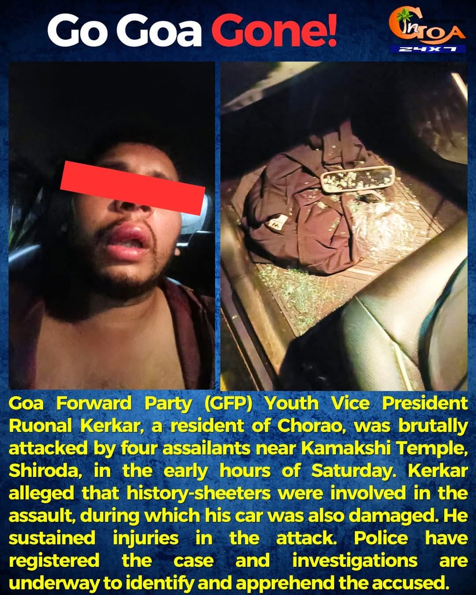 Our Goa Forward Party Youth Vice President, Mr. Ruonal Kerkar was brutally attacked yesterday. We strongly condemn this cowardly act. Such incidents prove that the Goa Govt. is in deep slumber, while CM remains busy with his political agendas instead of ensuring law and order.