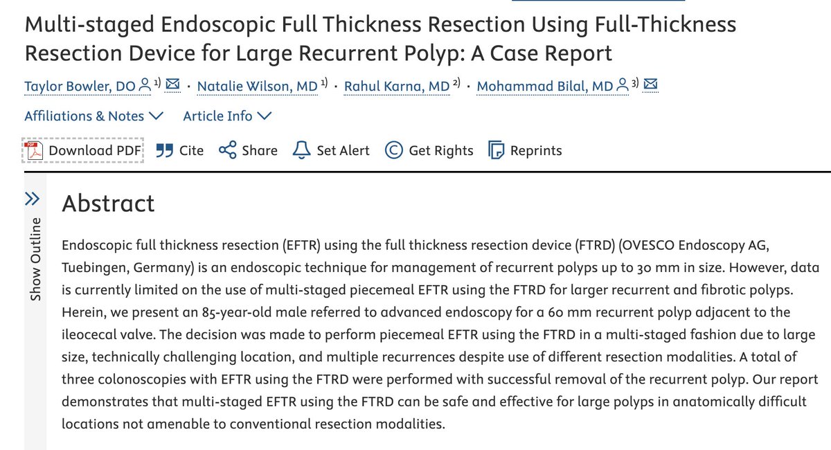 RahulKarnaMD's tweet photo. 🚨 Large, recurrent polyps near IC valve 🤯 can be difficult to ✂️
Check out 👇 case @iGIEjournal demonstrating feasibility of:
Multi-staged #EFTR for ✂️ large, recurrent polyp in challenging locations
@BilalMohammadMD @nataliejowilson #TaylorBowler https://t.co/TFX0dglCOz