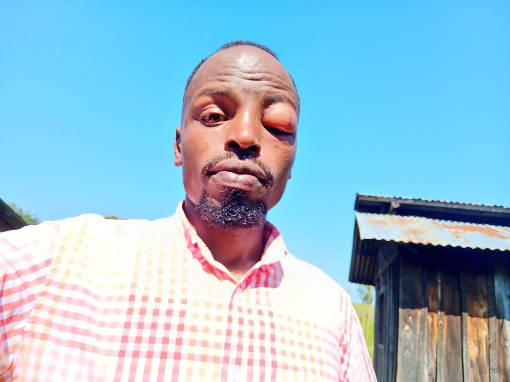 Another bad day in the office 😅😅
This is a call to have an apiary. 🐝
African Business 🌱 🌾 🚜